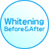 �z���C�g�j���O��Before��After